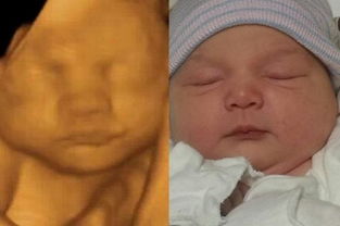 孕期做四维时的宝宝,和出生后颜值差距有多大 一组图片告诉你