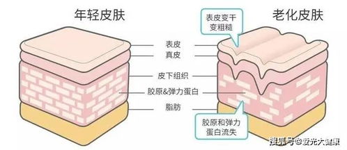 皮肤松弛松垮是什么原因引起