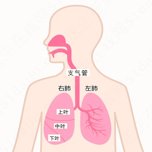 肺癌晚期症状 肺癌病人晚期症状 肿瘤 