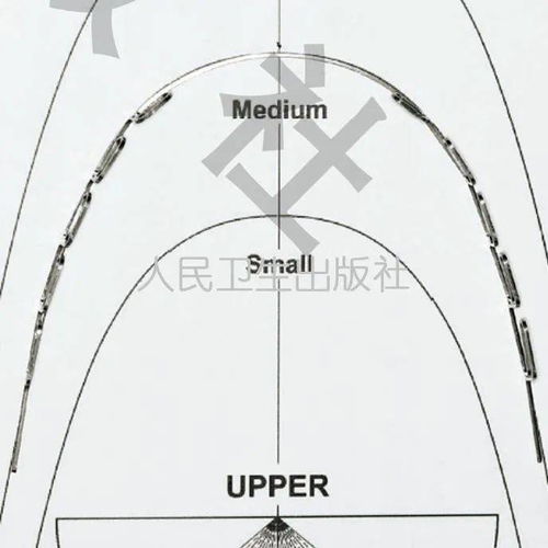 基本MEAW弓丝的弯制和应用