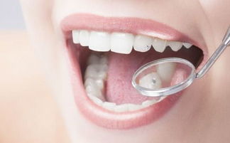 如何保护牙齿 保健牙齿的5个小妙招