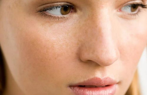 6种皮肤发黄 不健康原因,想变白其实很容易