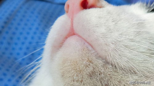 猫粉刺黑头不能挤,早期症状日常护理更关键