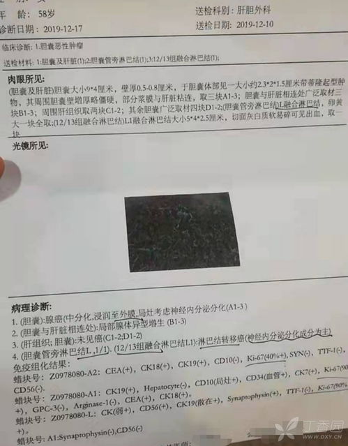 这样的病理结果该如何选择