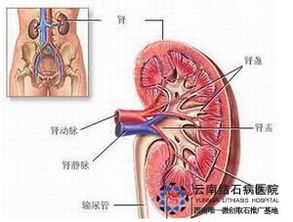 左肾囊肿需要治疗吗(左肾囊肿需要怎么治疗)