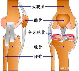 膝关节置换后多长时间能自由行走,术后住院要多长时间