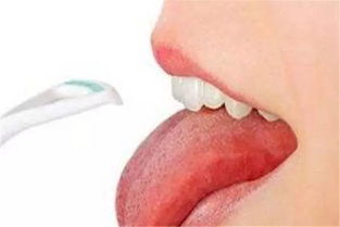 先锋健康丨从舌头看出健康问题 自测只需5秒钟