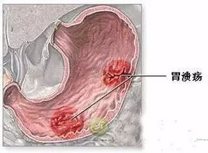 有没有胃病 看完就知道了