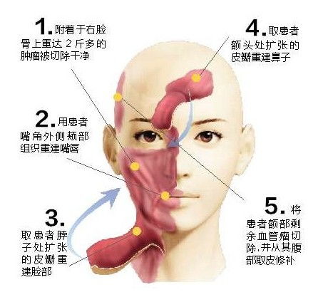 脸部骨头分布图 搜狗图片搜索