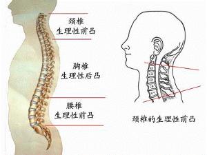 頸椎曲度變直反弓圖片 - 搜狗圖片搜索