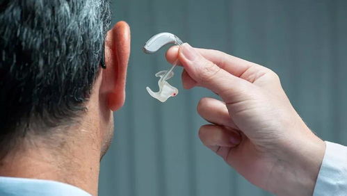 聪茂听力营山中心分享——有哪些原因会导致后天性听力损失？
