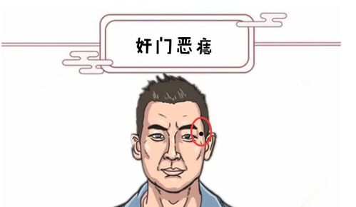 男人脸上四颗 倒霉痣 ,运势受阻,事业坎坷