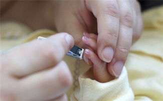 乱给孩子剪指甲后果很严重,十个妈妈九个都剪错了