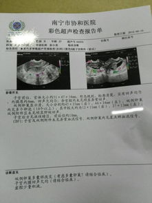 月经第三天激素全项:促卵泡成熟素10.03黄体生成激素5.57雌二醇96.20血清泌乳素212.0