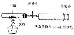 试管什么是fet方案,试管婴儿:FET计划是什么?