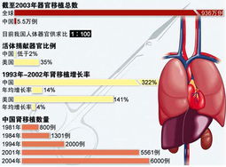 解读卫生部严限为外国人实施器官移植背后