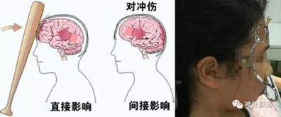 小儿神经外科的前世今生 中华医学会第五届全国小儿神经外科学术会议特辑 一 