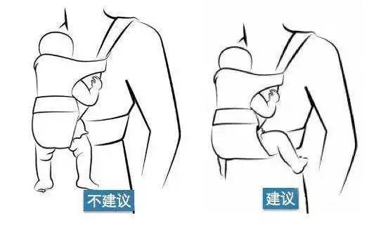 宝宝长期用纸尿裤会形成八字腿吗