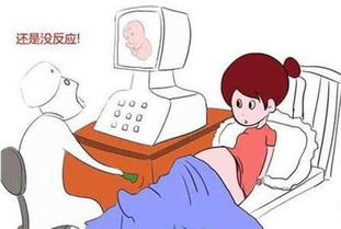 过了预产期还没有生 这几类孕妈需要催生,其她孕妈不需要太着急