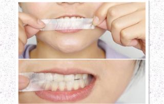 美白牙贴对牙齿有伤害吗 长期用美白牙贴警惕牙齿受伤