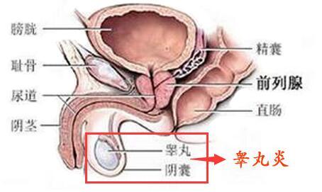 睾丸发生疼痛的原因