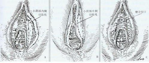 阴蒂的基本形态与作用