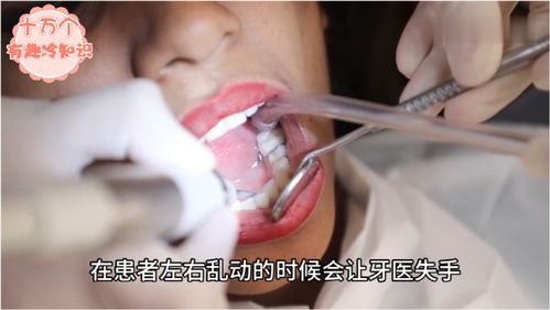 牙医没告诉你的5个关于牙齿的秘密 