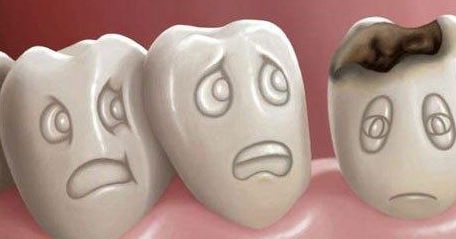 牙根肿发炎是怎么了 医生 牙龈还会长脓包,这2种方法快速处理