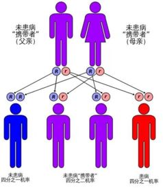 精准筛查基因 隐形杀手 让后代不在 无力 