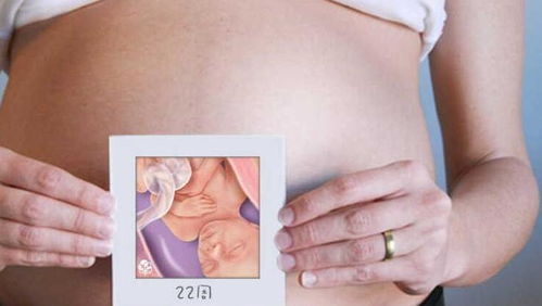 怀孕期间,如何知道肚子里是男孩还是女孩 这三个检测方法最科学