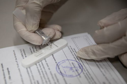 国际疫情 巴西确认两例感染 德尔塔克戎 毒株病例