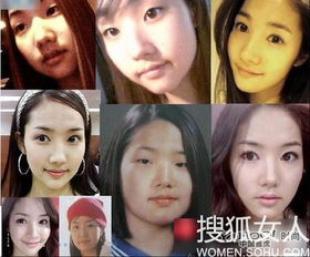 韩国双胞胎整容变女神逆袭 盘点整容改变命运的女星们
