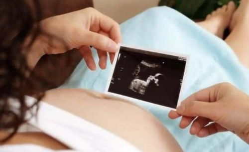 原创孕期，准妈妈若有3种“表现”，恭喜你，或许是怀了位“小格格”