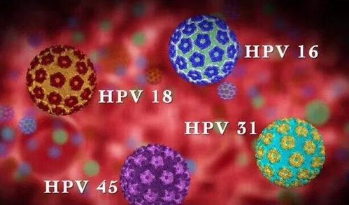 宫颈病变的五个阶段(宫颈感染了HPV病毒)