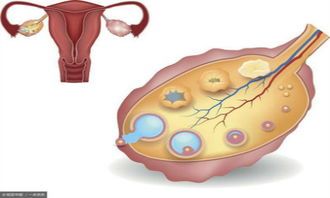 卵巢里有多少个卵泡正常，卵巢有几个卵泡算正常