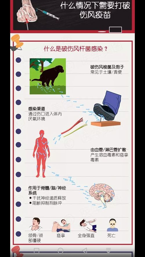 什么情况下需要打破伤风疫苗 转载 