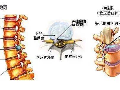 筋膜与脊柱的 暧昧关系