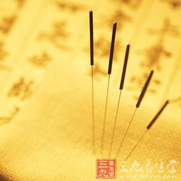 中国发布18项针灸标准 针灸疗法并非都适合 