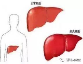 保肝护肝的神药 二十五味绿绒蒿丸