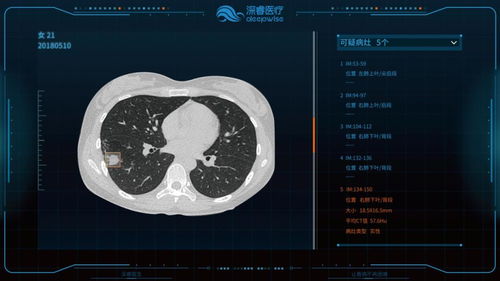 红外线热成像查出胃有问题