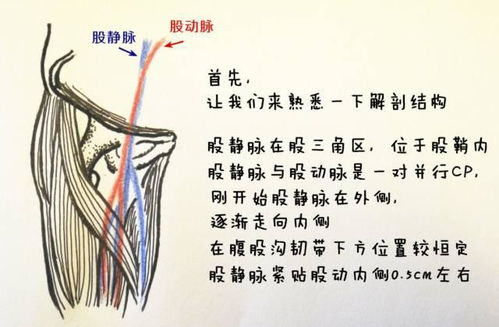 双侧股总静脉中度返流是什么原因引起的，最终会导致什么结果？