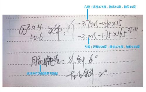  axs视力165 百科