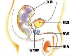 专家不建议取前列腺液