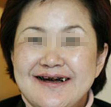 带婆婆去镶牙,我出去上个厕所,回来摸到诊室门把手,我撒腿就跑