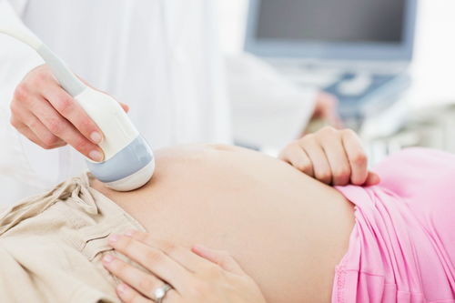 孕早中期胎盘低置怎么办 保胎 要点需牢记