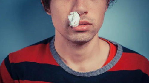 单侧鼻子出血会是癌症 反复流鼻血需警惕暗示这件事,老是鼻出血是怎么回事
