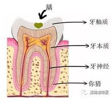 廊坊家长注意 我市5岁儿童多一半都有这个问题 千万别忽视