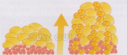 脂肪液化怎么处理恢复快,脂肪液化，快速