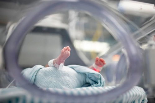 26周超早产双胞胎！山东省中医院多学科联合再创生命奇迹
