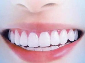 赤峰冷光牙齿美白技术,牙齿冷光美白是怎么美白的?